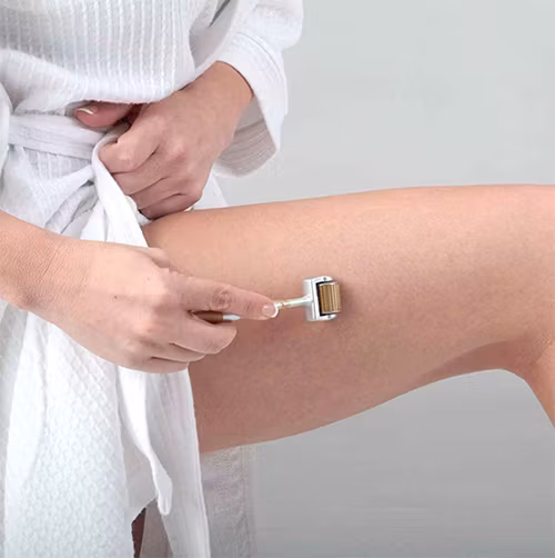 Hudroller mot celluliter