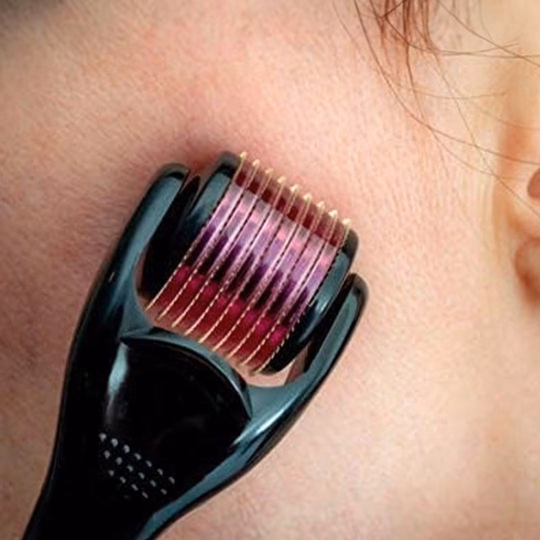 Dermaroller 2.0mm