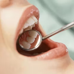 Munspegel / tandspegel