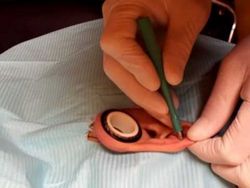 Dermal Punch