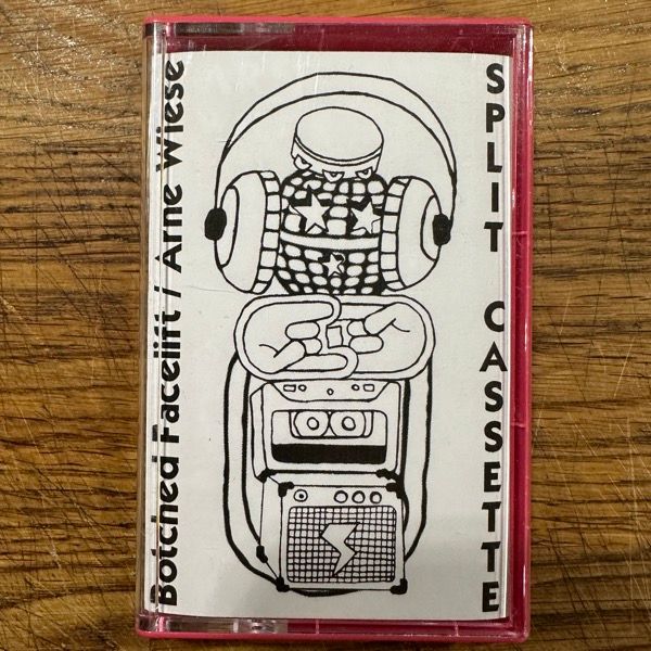 BOTCHED FACELIFT / ARNE WIESE Split (UFOODD - Sweden original) (NM) TAPE