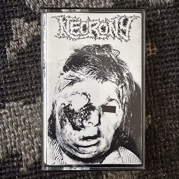 NECRONY  Severe Malignant Pustule (Self released - Sweden original) (EX) TAPE