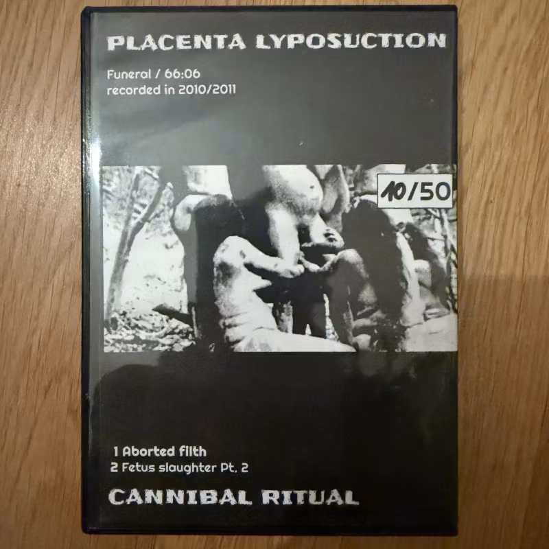 PLACENTA LYPOSUCTION / CANNIBAL RITUAL Gruesome Abortion (Meat Hook Butchery – Germany original) (NM) 2xCDR