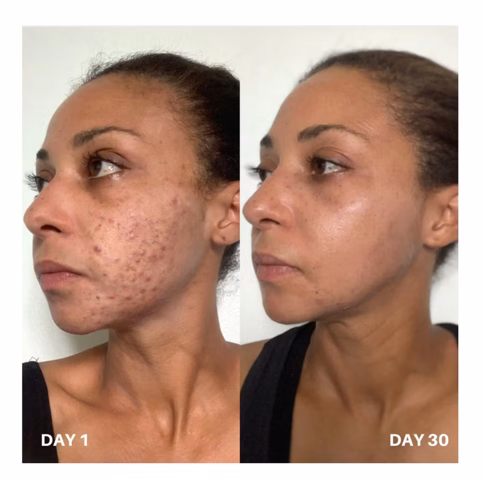 Clinisoothe skin purifier