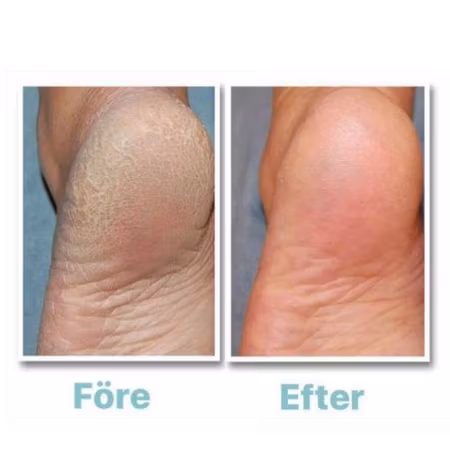 Problem Dry Skin Cream