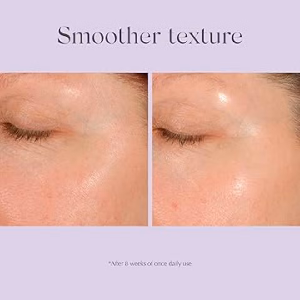 Daily resurfacing peel ca10