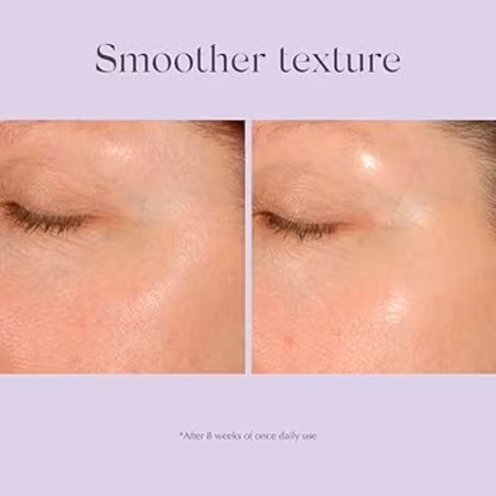 Daily resurfacing peel ca10