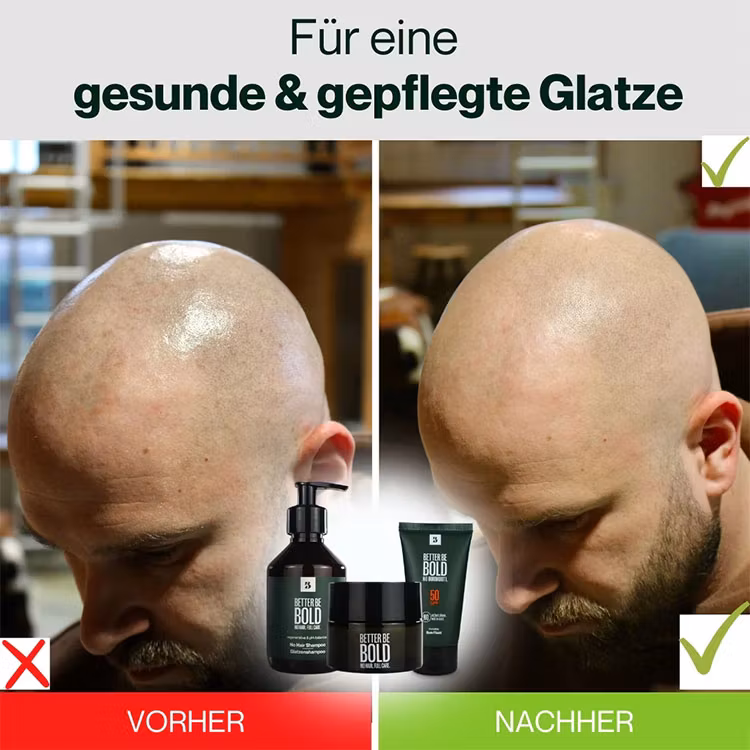 Better Be Bold Anti-Pigment Bald Serum 30 ml