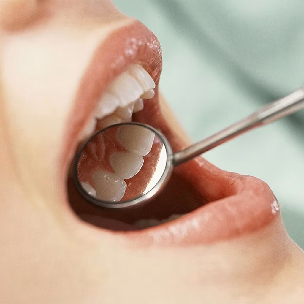 Munnspeil / tannspeil