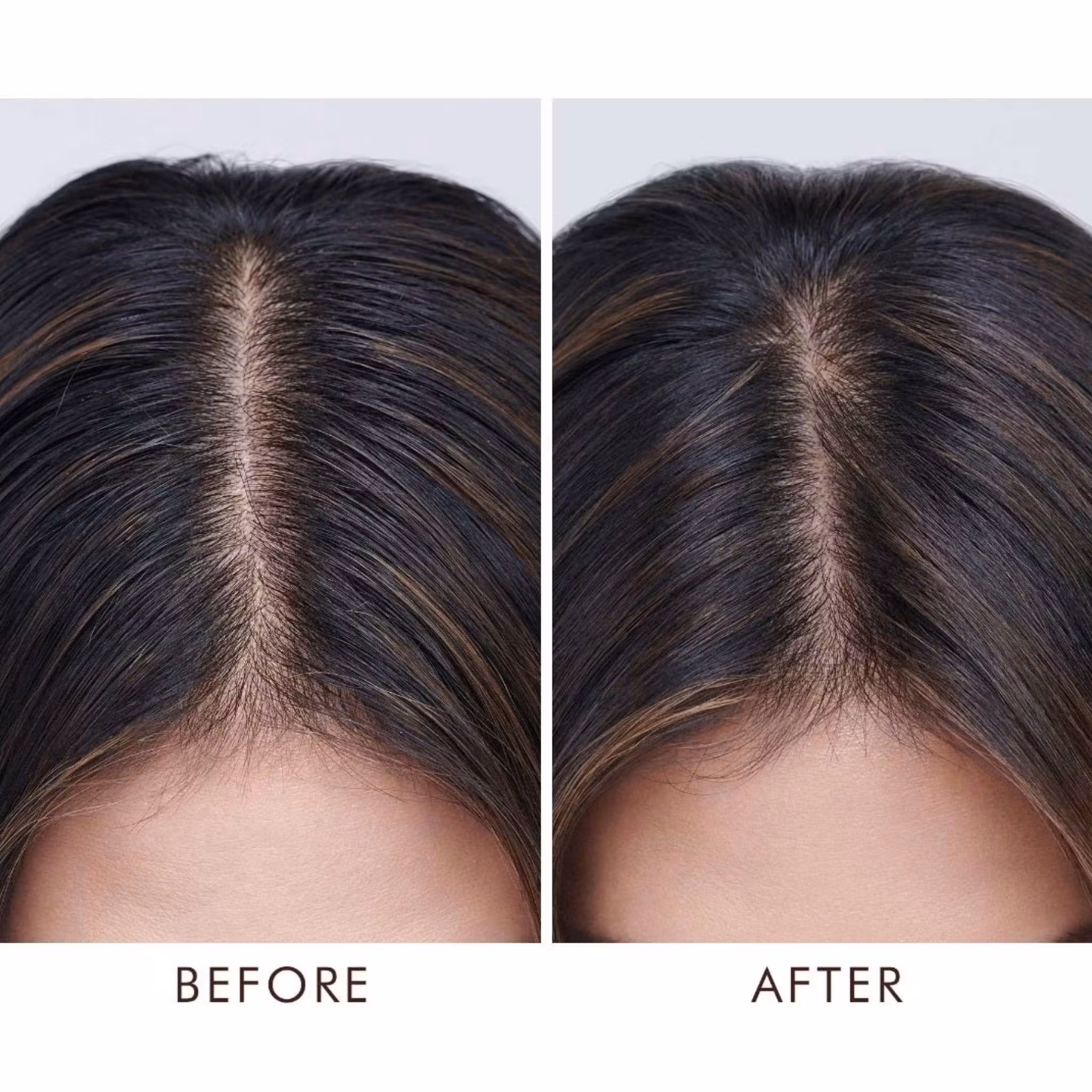 Moroccanoil - Oily Scalp Treatment (Fet hårbotten)