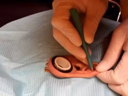 Dermal Punch