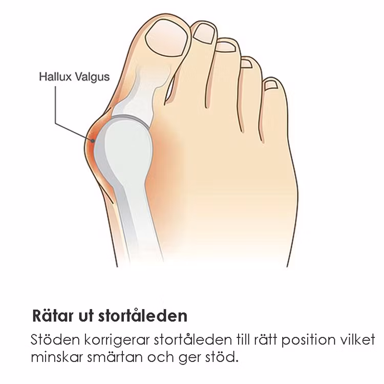 Hallux valgus beskyttelse (2-pak)