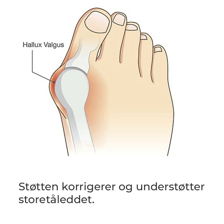Hallux Valgus støtte