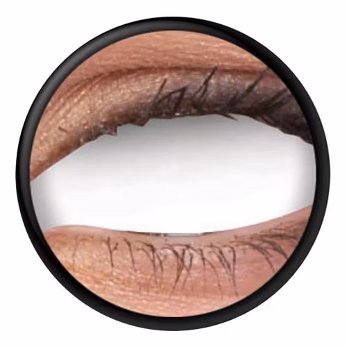 Scleralinser Blind Spot