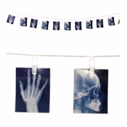 Girlang med LED-belysning Röntgen