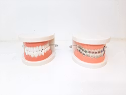 Dental tandmodell / Löständer (tand modell)