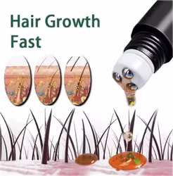 Fast Hair Growth Oil for Men – effektivt serum mot håravfall