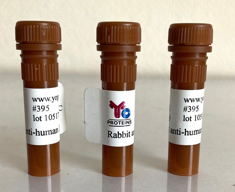 395 Rabbit anti-human IgA polyclonal antibody 1 mg