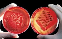 Helicobacter Pylori (Mag-tarm bakterie) - (Norvia 17)