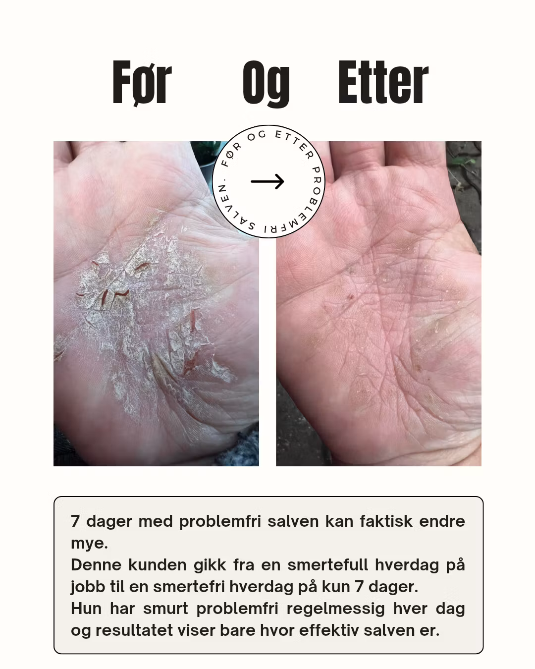 Problemfri prøve 10ml