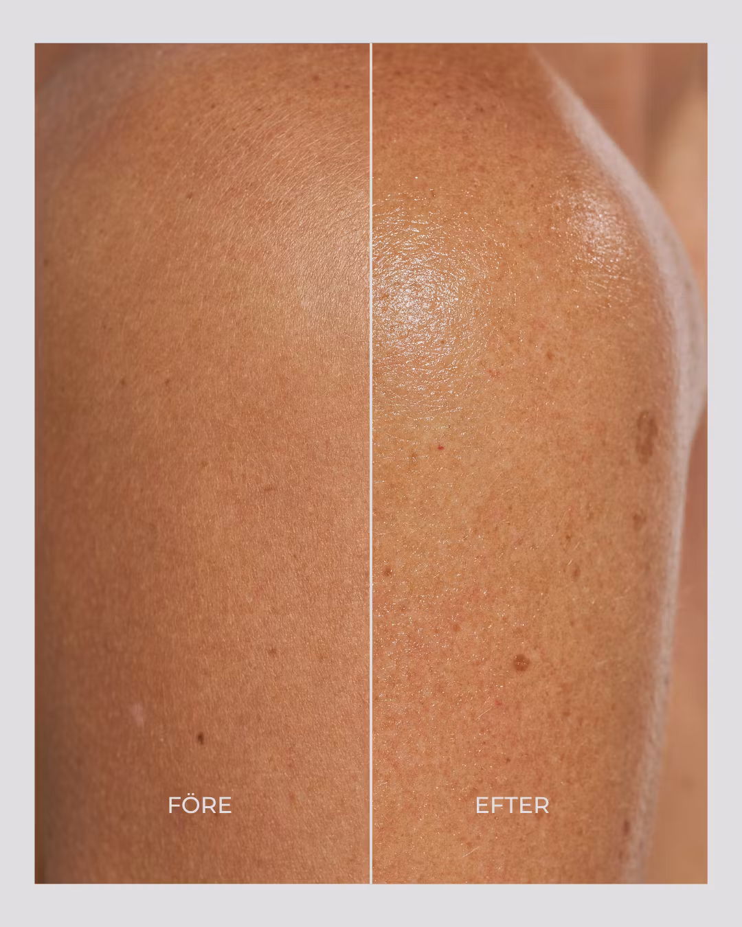 Swederm Gel Trap - Pink Revolution