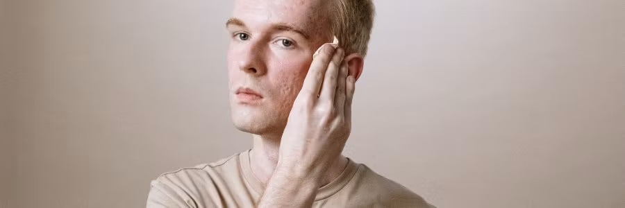 Naturlig hudpleie for menn – slik velger du riktige produkter