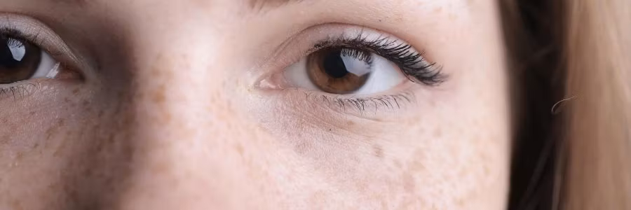 Environ Mela Fade Serum mot pigmentflekker