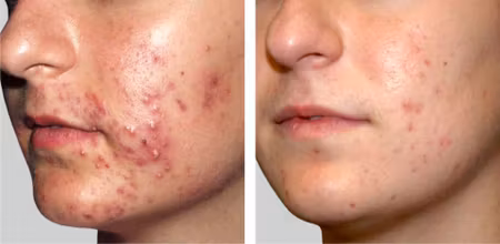 outlet ENVIRON Focus Care Clarity Sebu Clear Mask, 50ml (dato 01/26)