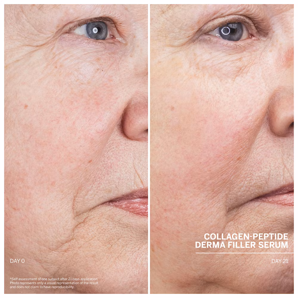 NYHET Dr Babor Collagen peptide derma filler serum 30 ml - Kollagenforsterkende serum