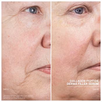 NYHET Dr Babor Collagen peptide derma filler serum 30 ml - Kollagenforsterkende serum