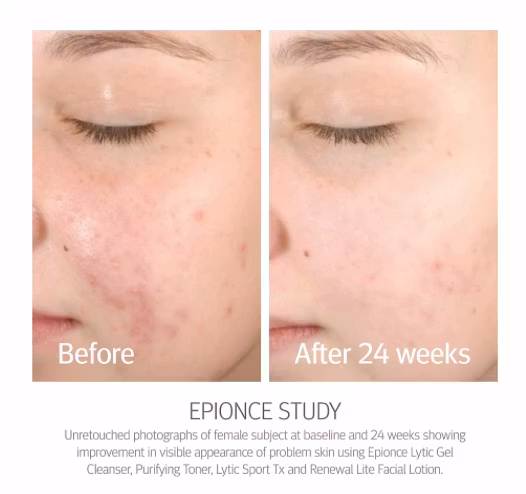 Epionce - Renewal Lite Facial Lotion (combination/ oily skin) 50 ml