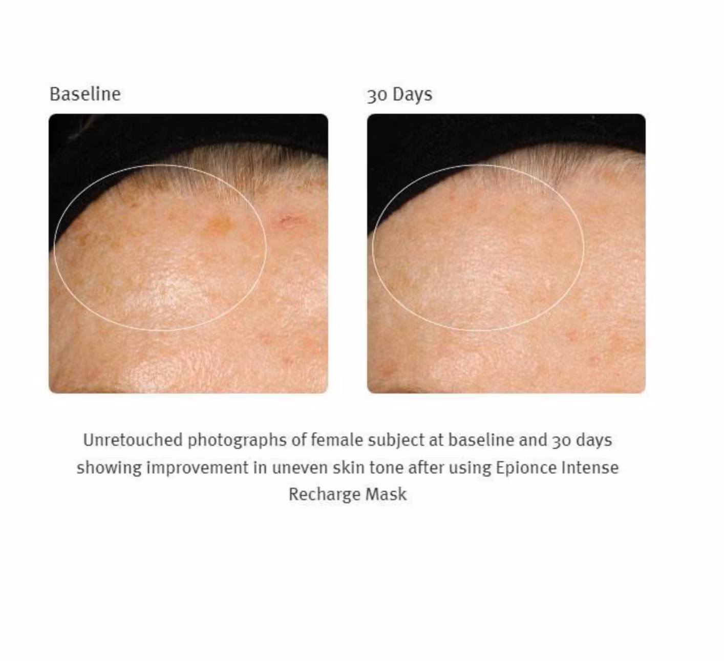Epionce - Intense Recharge Mask