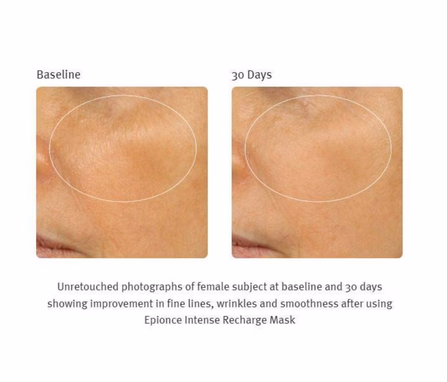 Epionce - Intense Recharge Mask