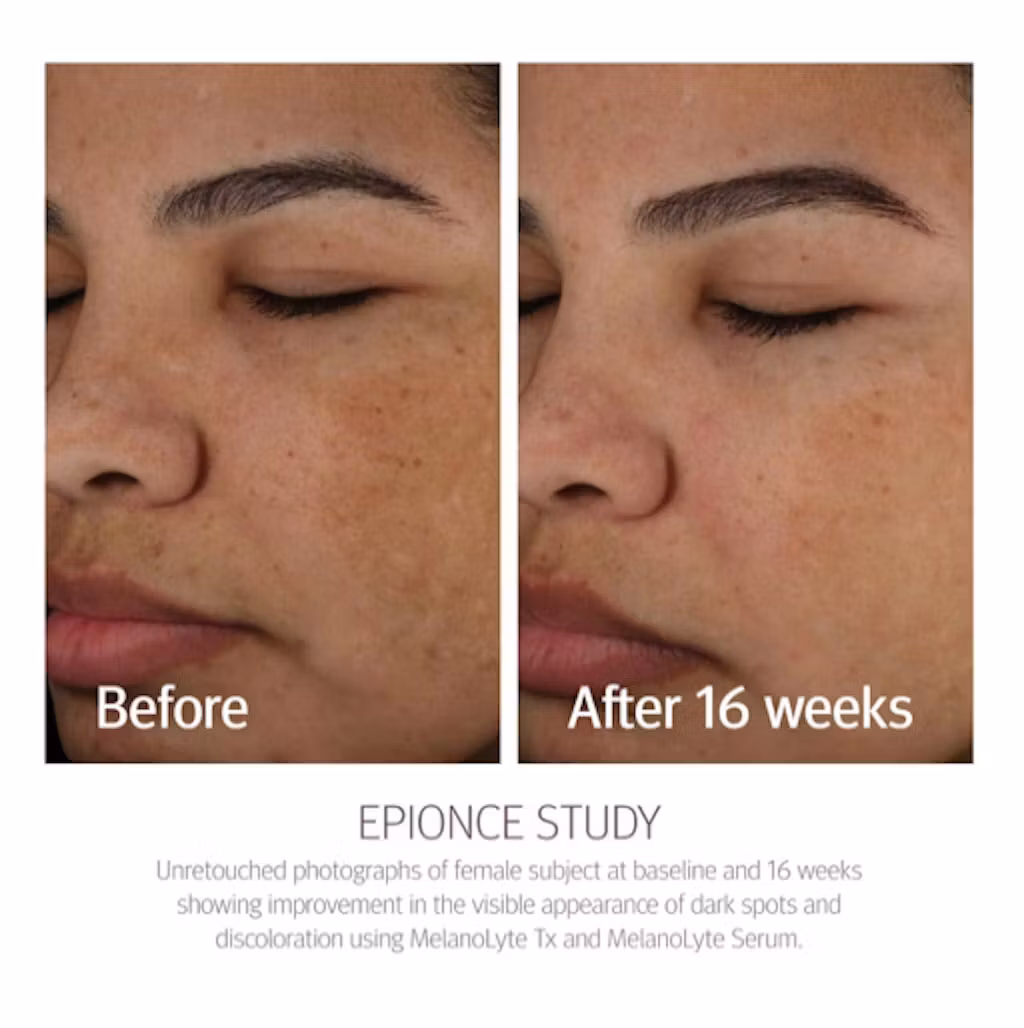 Epionce - MelanoLyte Tx 30 ml