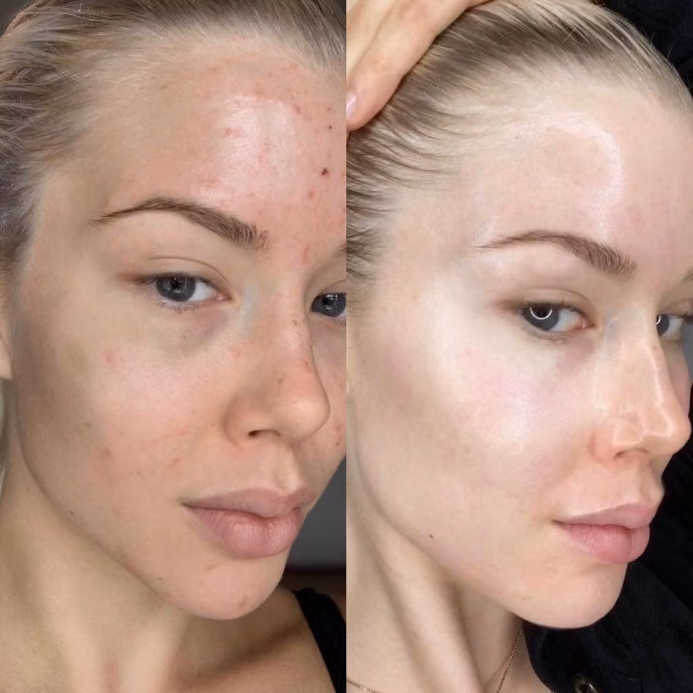 Online utbildning i Glass Skin
