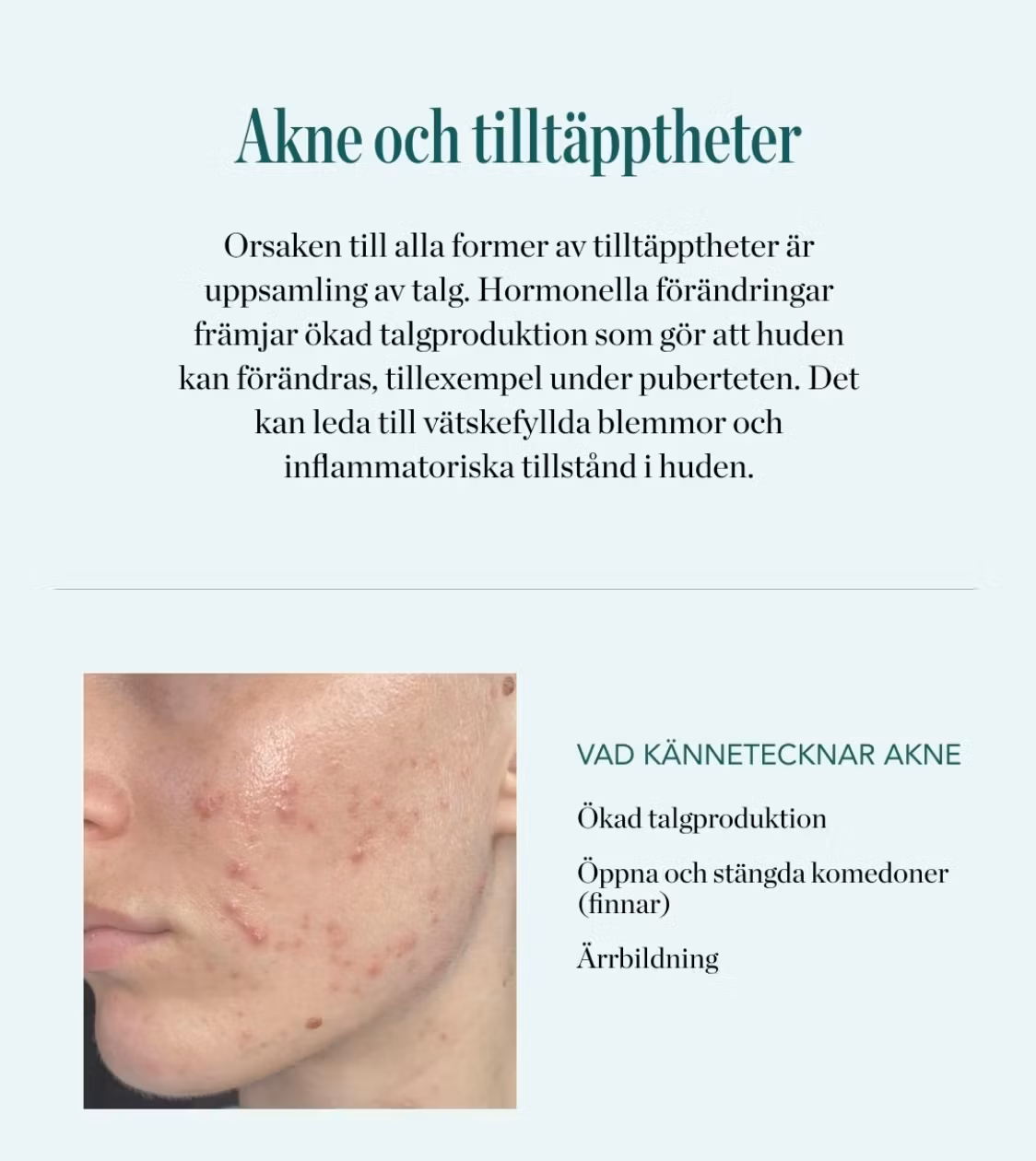 Elixir SOS Paste - svavelkräm