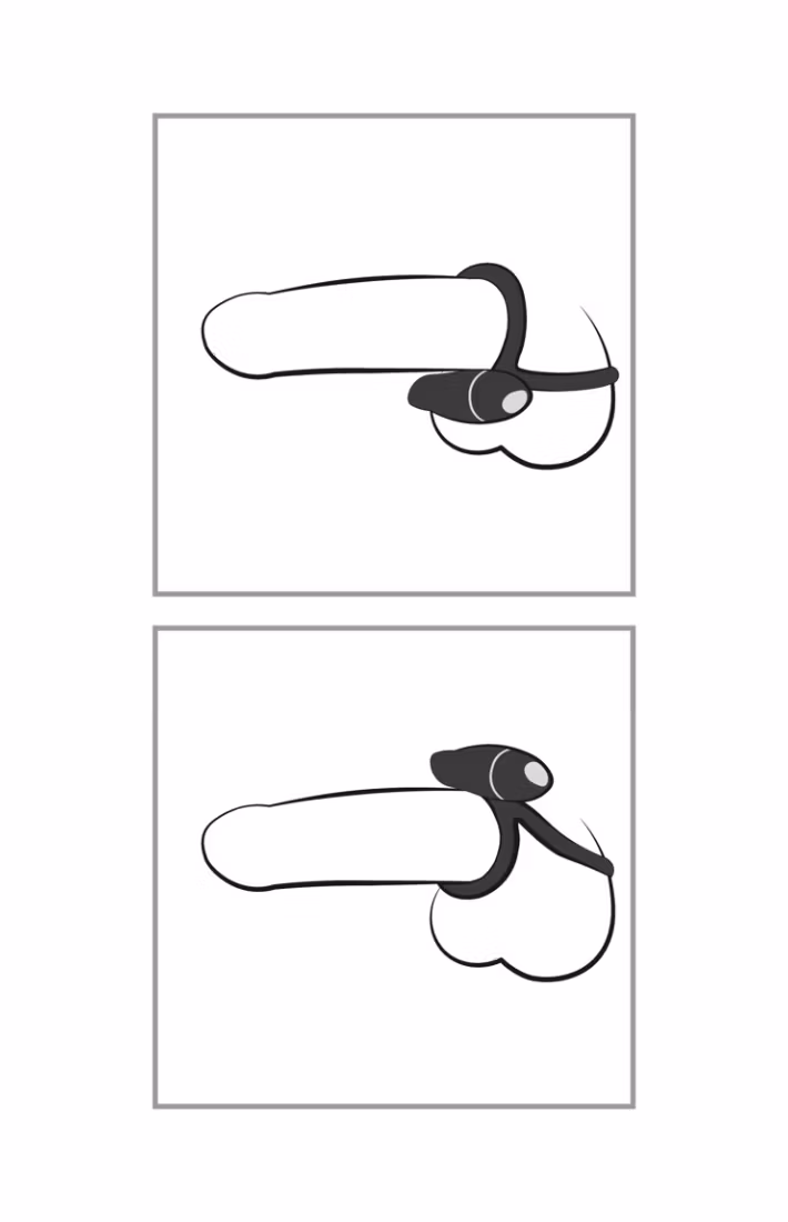 Smile Skill
