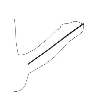 Spiral Dilator Set