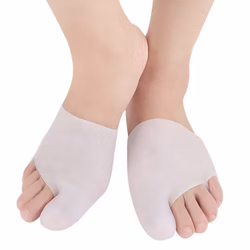 Hallux valgus (sok)