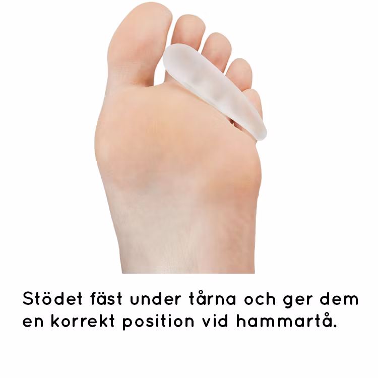Hamerteen (2 st. steunen)