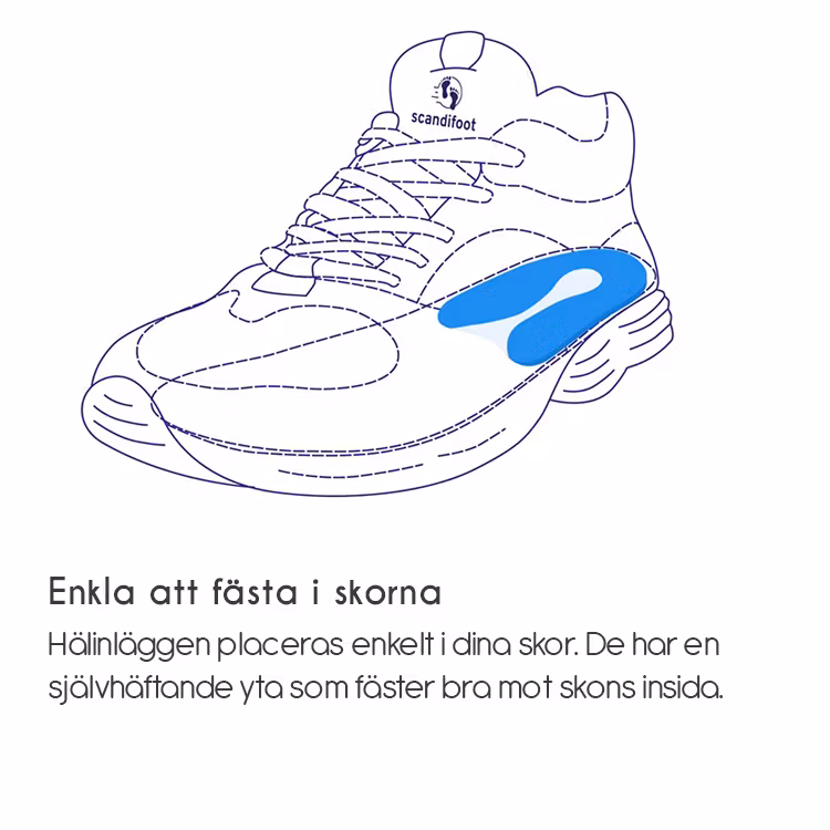 Inlägg för hälsporre