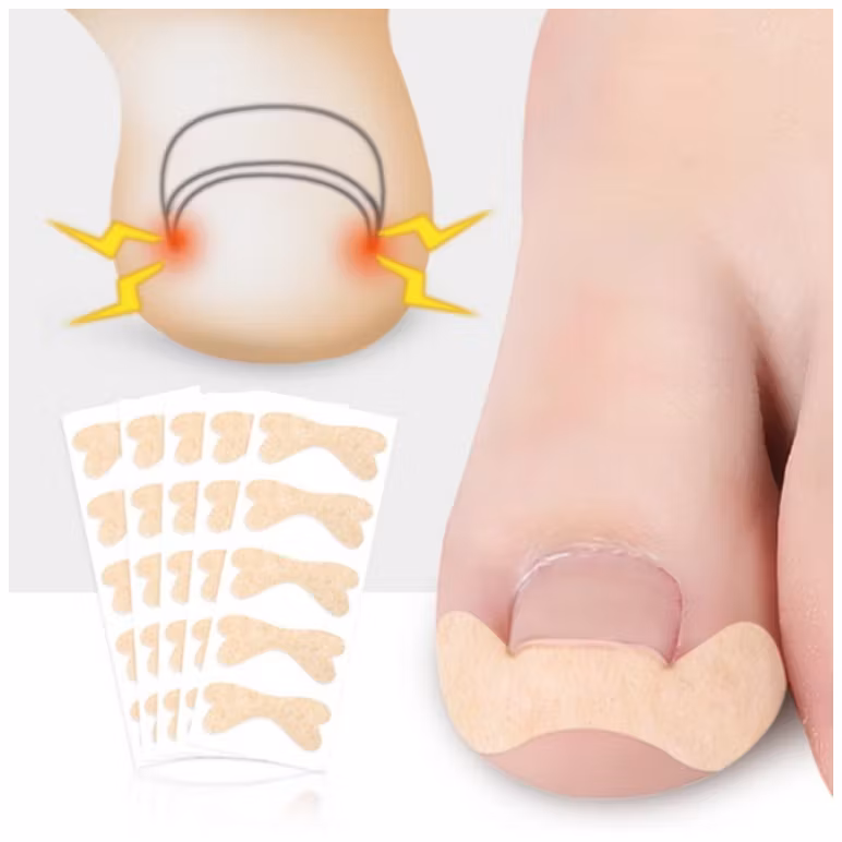 Nageltrång (Tejp)