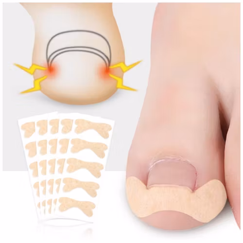 Nageltrång (Tejp)