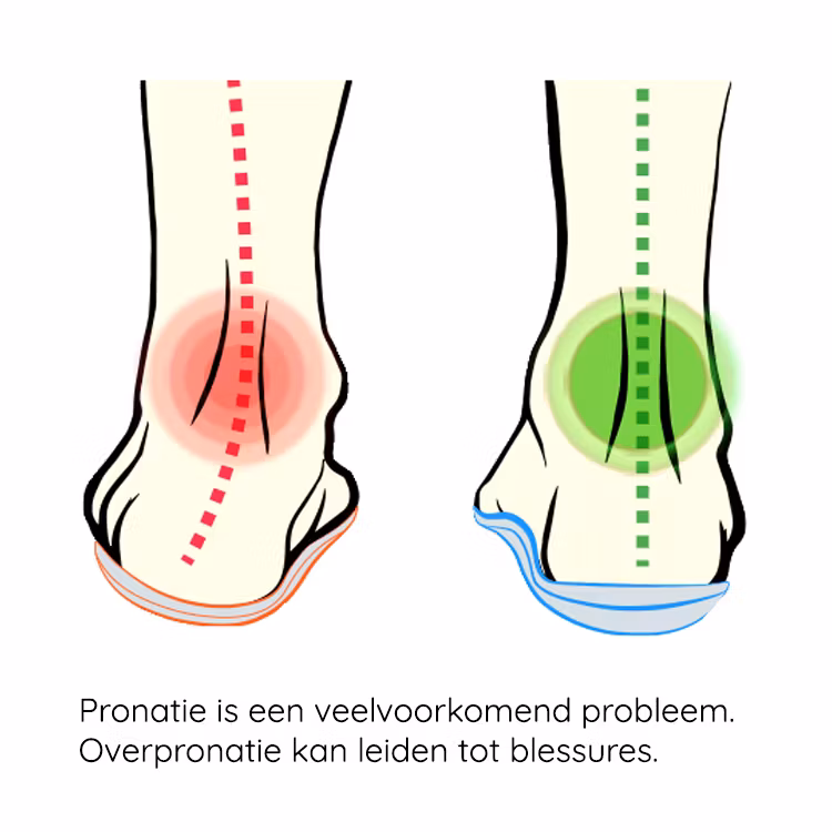 Inlegzolen pronatie (basic)