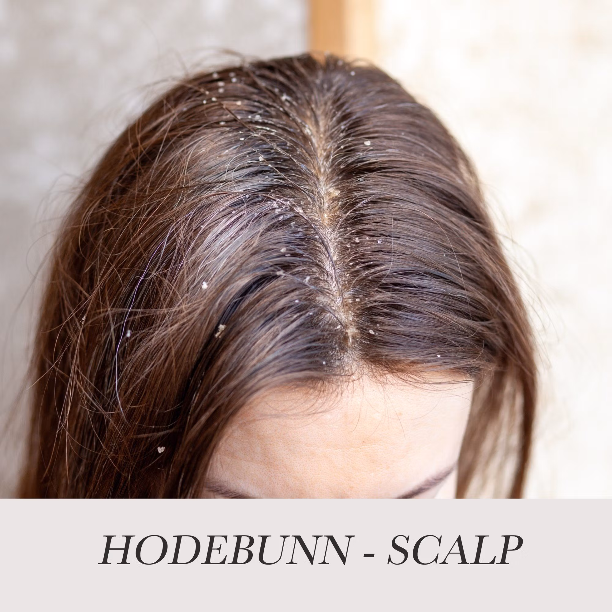 Scalp Sjampo - LaLuna PRO AS