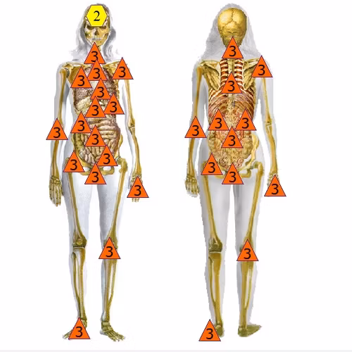 HÅRanalys med Oberon -Människa
