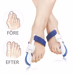 Hallux valgus korrigerande stödskena 2st