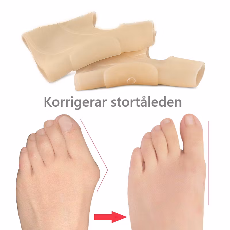 Hallux valgus korrigerande stöd, silikon 2st