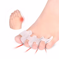Hallux valgus korrigerande tåseparerare, STORT AVSTÅND 2st