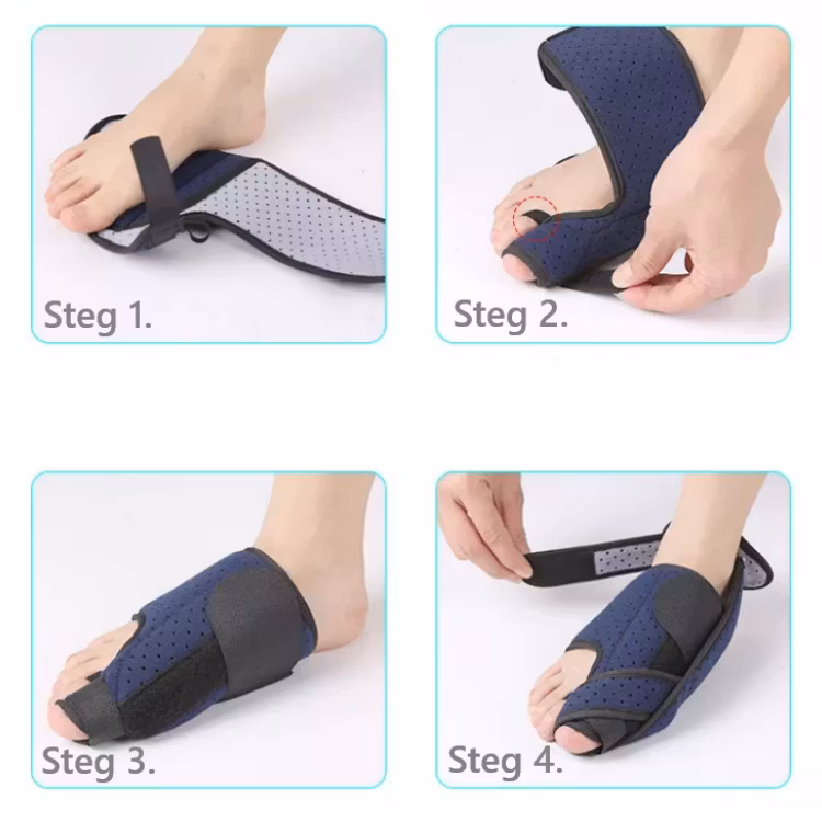 Hallux valgus korrigerande stödskena i textil